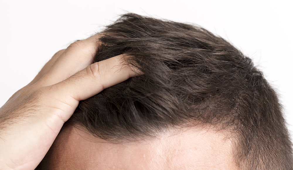 Saç Ekimi Kesler Clinic Çerkezköy